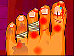Docteur du pied de monstre